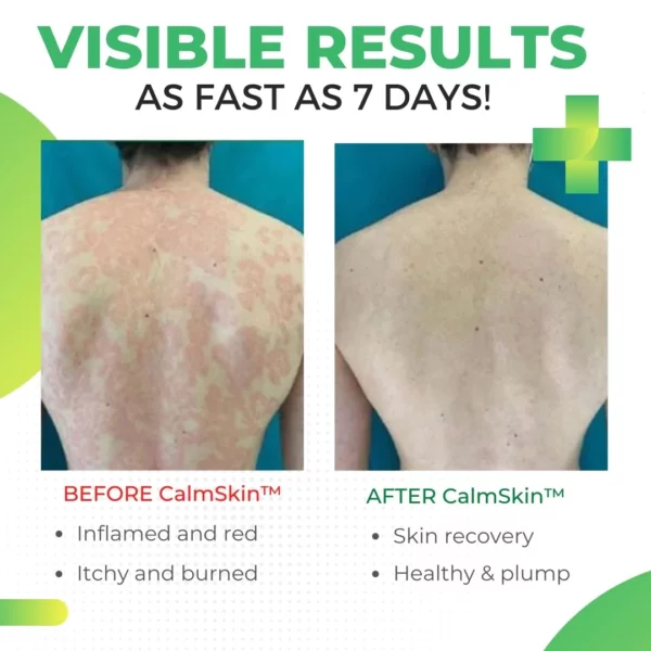 CalmSkin™ Psoriasis Defense Body Wash - Image 5