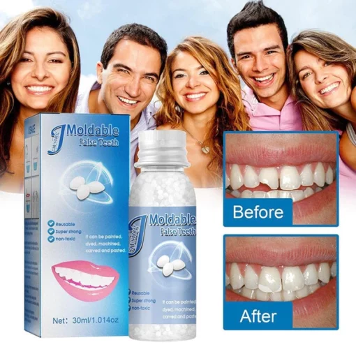 Oveallgo™ Tooth Repair Granules