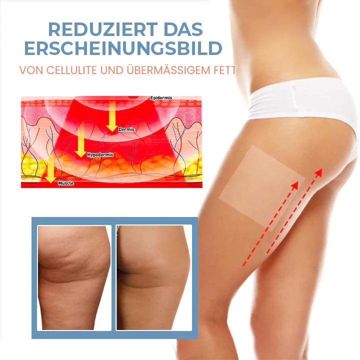 Oveallgo™ Zelle PURI Straffen Anti-Cellulite Kollagen-Straffungspflaster - Image 5