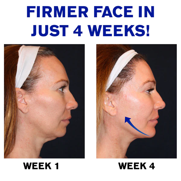 Ricpind EMS SkinLifting FaceSculpting Device - Image 6