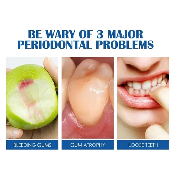 GFOUK™ Repair and Protect Aufhellende Zahnpasta - Image 6