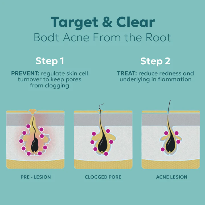 PureBAC™ Back Acne Herbal Spray - Image 5