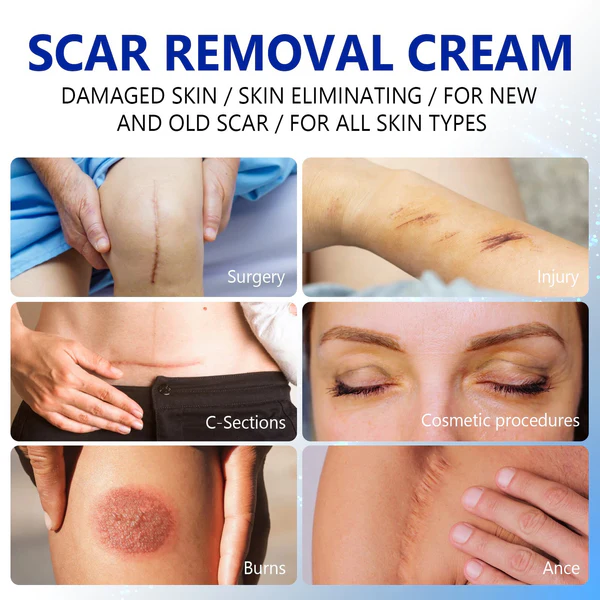 SkinRevive™ Advanced scar cream - Image 5