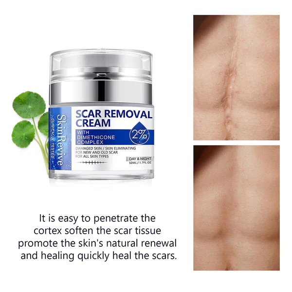 SkinRevive™ Advanced scar cream - Image 4