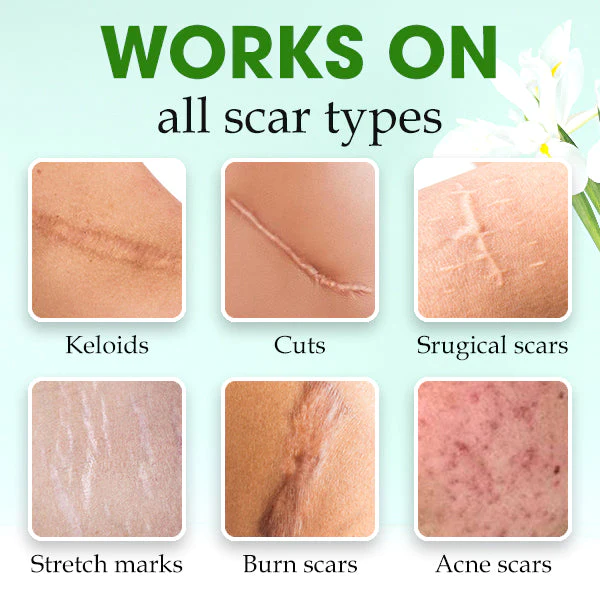 SkinFix™ Scar Repair Essence - Image 4