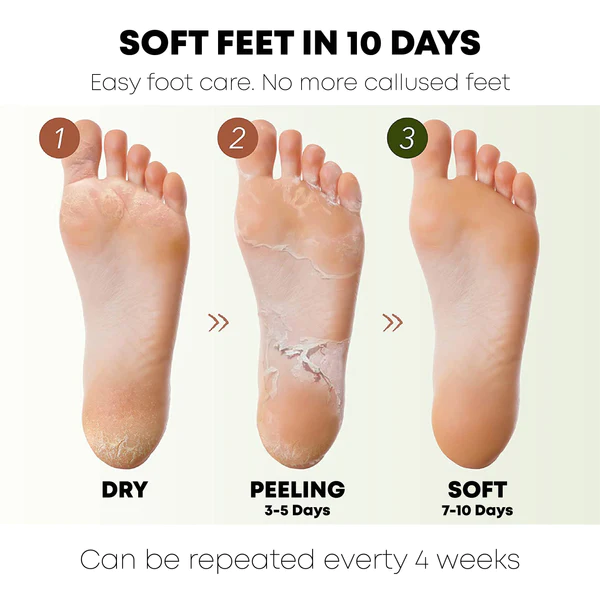 ATTDX FootCalluses CornRemoval Treatment Spray - Image 5