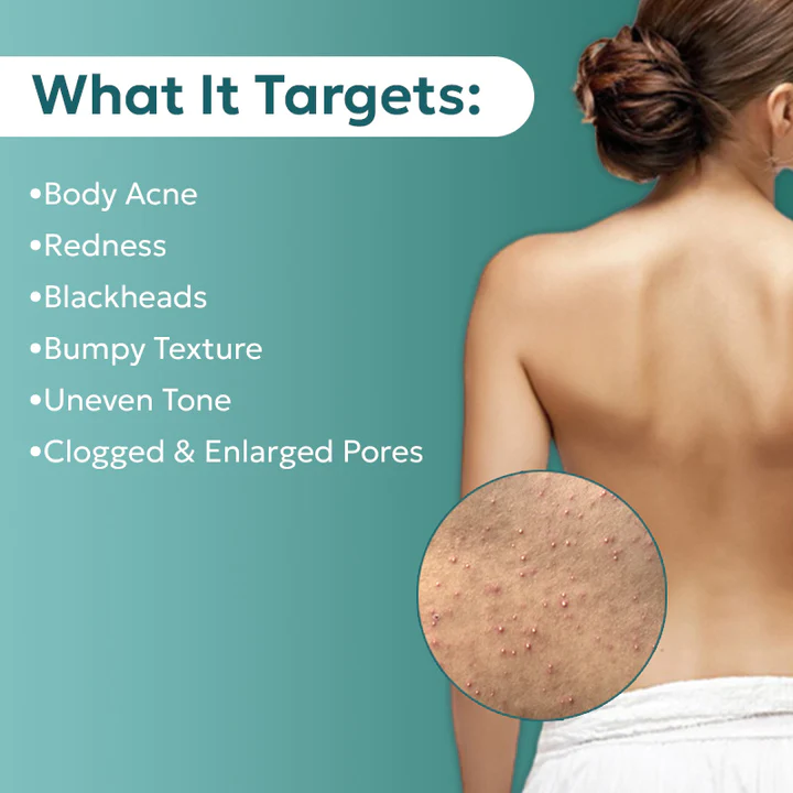 PureBAC™ Back Acne Herbal Spray - Image 4