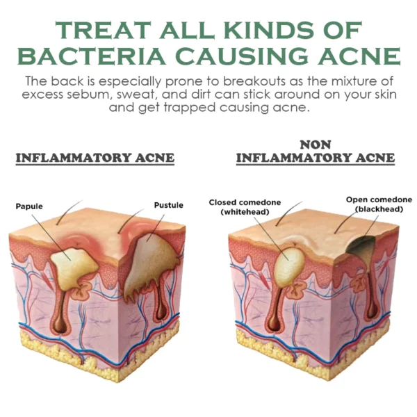 ATTDX BodyAcne Removal Cleanser Spray - Image 3