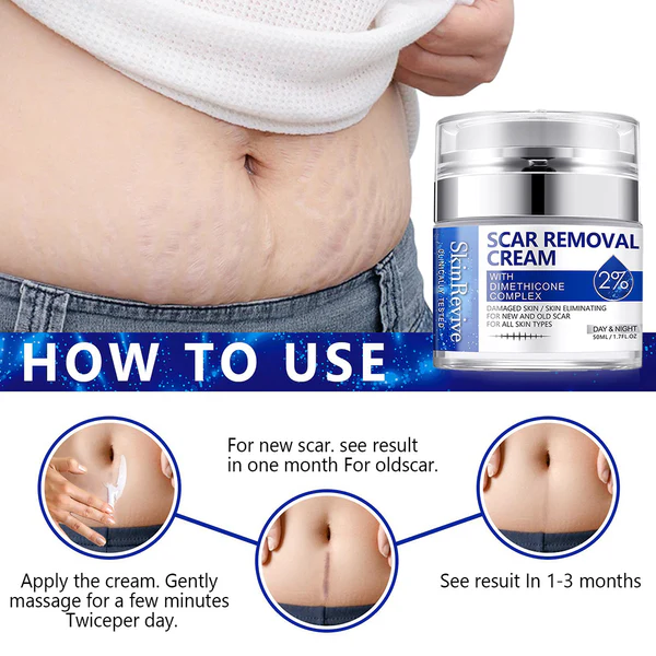 SkinRevive™ Advanced scar cream - Image 3