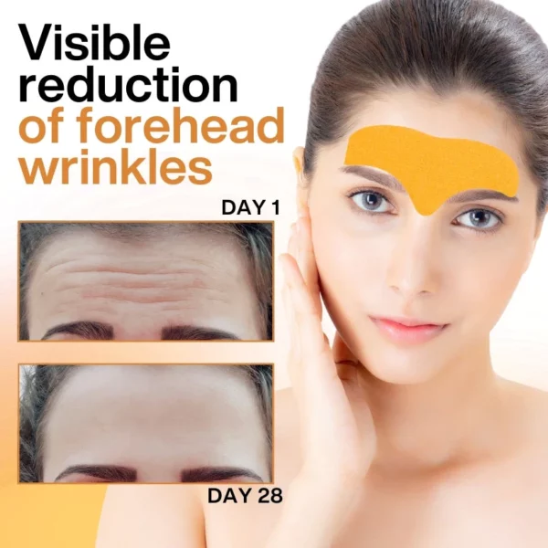 DermaBliss™ Forehead Wrinkle Patch - Image 4