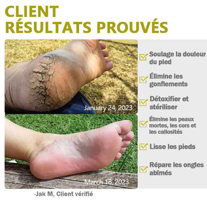 NatureFoot™ Huile Essentielle Bain de Pieds Comprimés Effervescents - Image 3