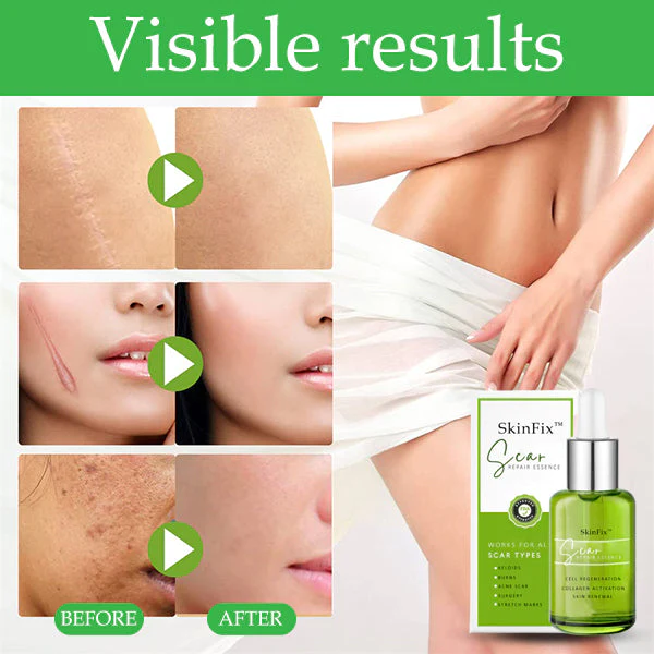 SkinFix™ Scar Repair Essence - Image 3