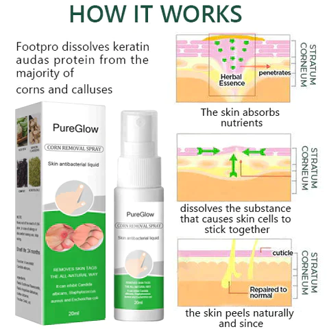 PureGlow™ Corn Remover Power Spray - Image 3