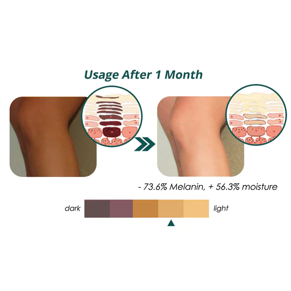 flysmus™ Seidenprotein-Melanin-Bleichseife - Image 3