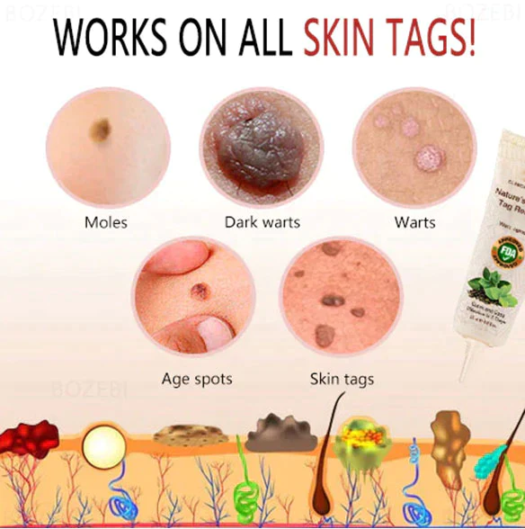 CC™ Nature’s ultimate Tag Remover - Image 4