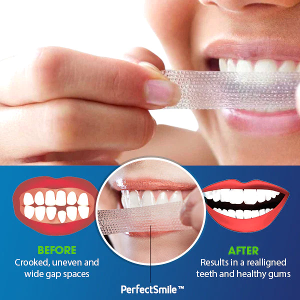 PerfectSmile™ Orthodontics Repair Stickers - Image 3