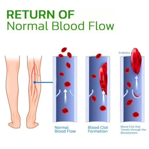 APMA® Plant Care Ice Silk Insoles - Image 4