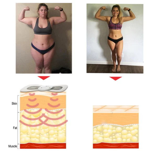 CNDB TENS Hypertension Therapy Massager Sticker - Image 7