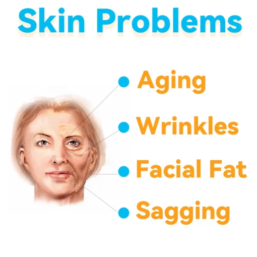 GFOUK™ HIFU Face Lifting Instrument - Image 9