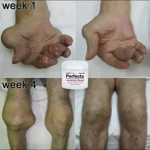Oveallgo™ FlexiCure Joint & Bone Therapy Cream - Image 7