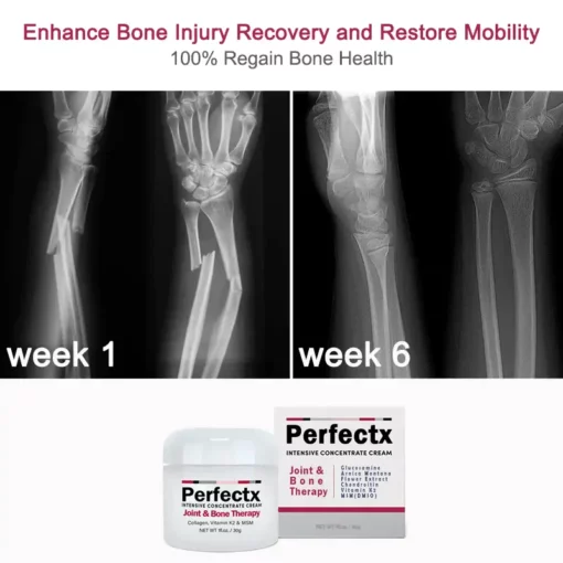 Oveallgo™ FlexiCure Joint & Bone Therapy Cream - Image 6
