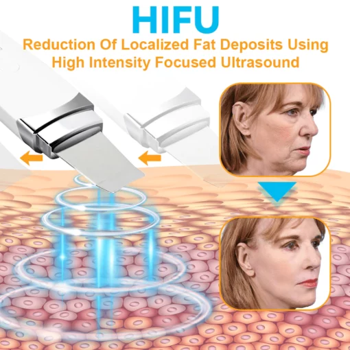 GFOUK™ HIFU Face Lifting Instrument - Image 8