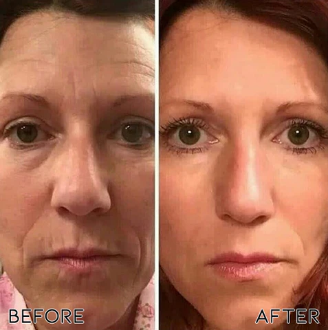 Oveallgo™ Rejuvenating Bioactive Collagen Nasal Inhaler - Image 6