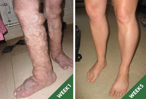 APMA® Plant Care Ice Silk Insoles - Image 6