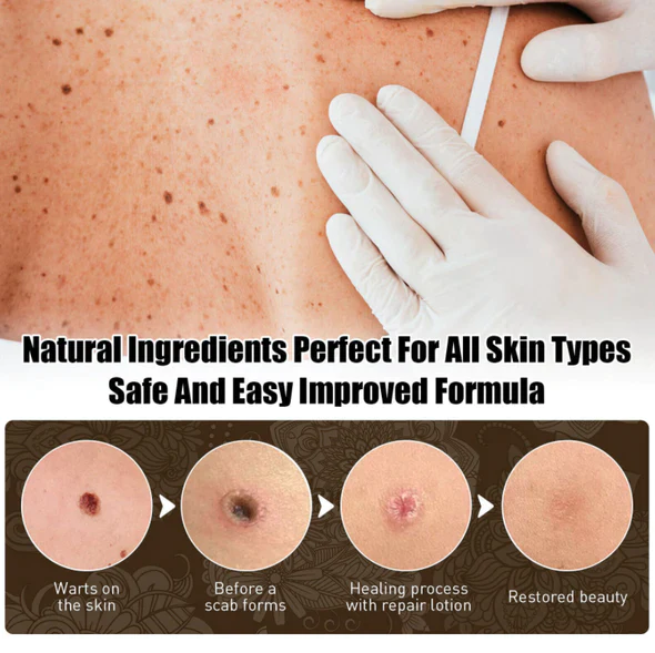 CC™ Nature’s ultimate Tag Remover - Image 7