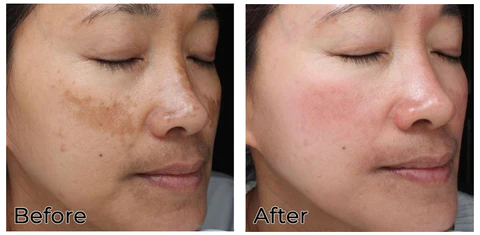 WE.Beauti™ Turmeric Natural Serum - Image 6