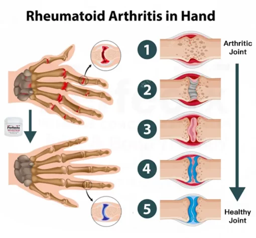 Oveallgo™ FlexiCure Joint & Bone Therapy Cream - Image 4