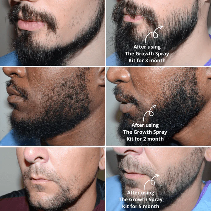 Hair Growth Kit - Image 4