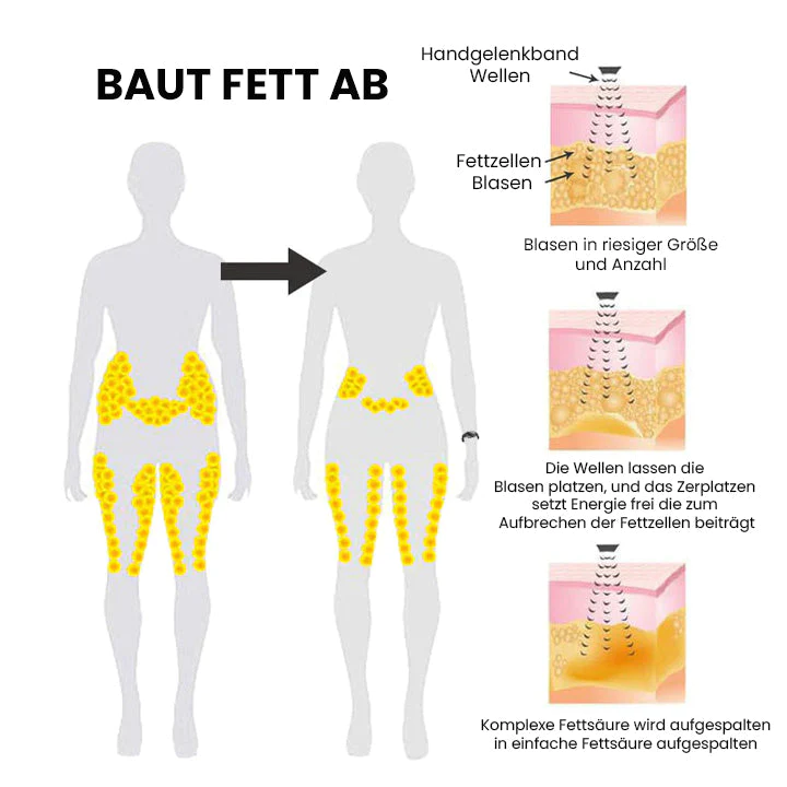 Oveallgo™ Ultraschall-X-Ultra-Tech-Körperform-Armband - Image 6