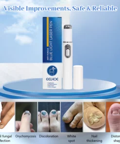 ARRIVALS Antifungal Laser Device Without Any Side Effects