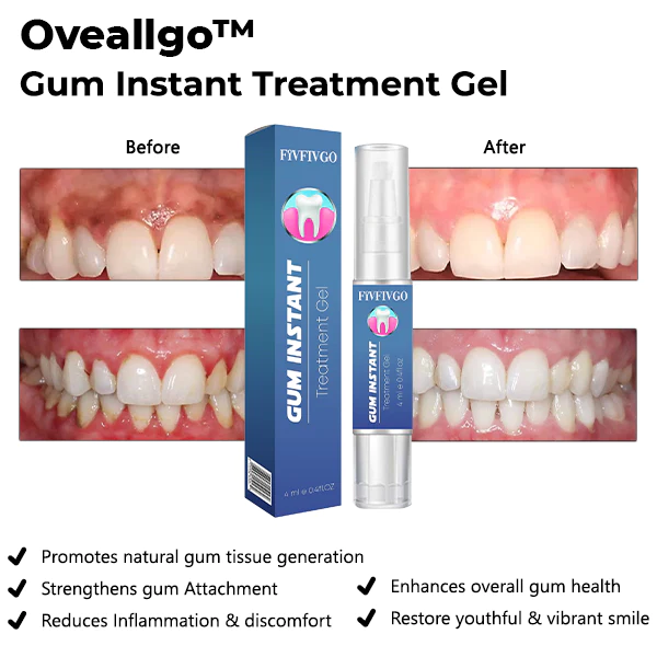 GFOUK™ Gum Instant Treatment Gel - Image 4