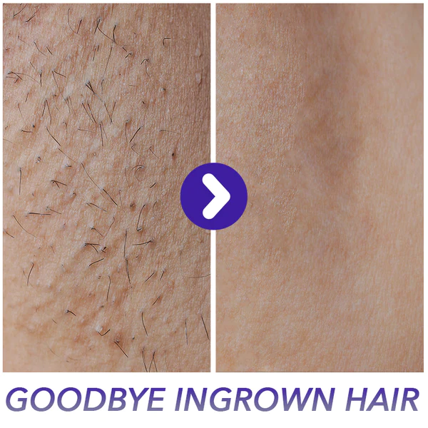 GLODIANT™ Magic Crystal Hair Remover - Image 7