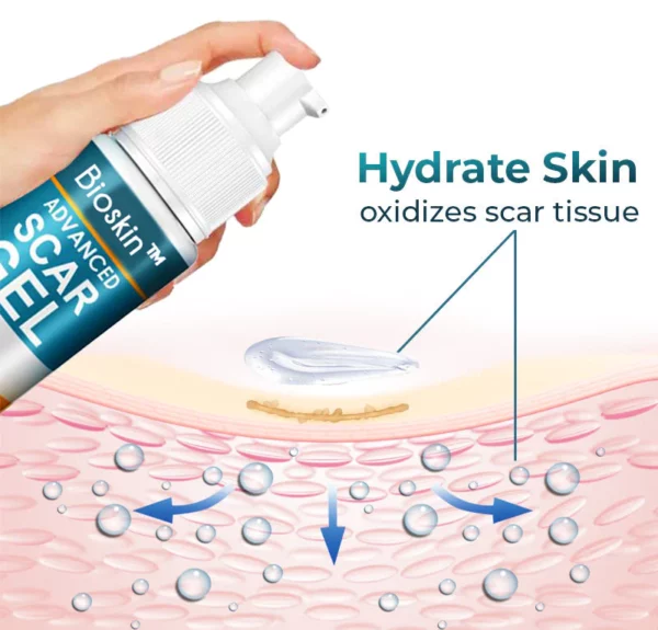 CNDB Bioskin™ Advanced Scar Removal Gel - Image 6