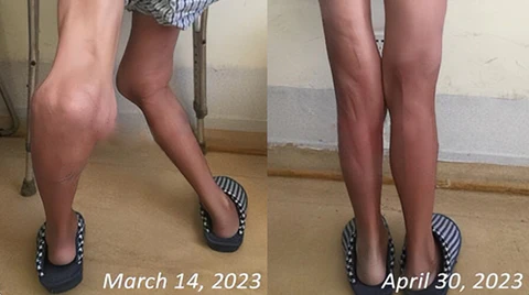 Wewersh® Bee Venom Joint & Bone Pain Relief Gel - Image 5