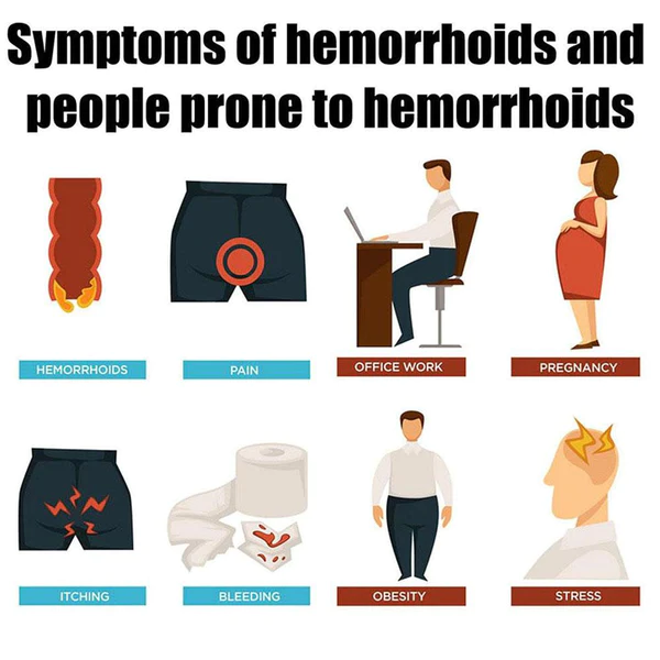 ProctRex™Hemorrhoid & Fissure Cream - Image 5