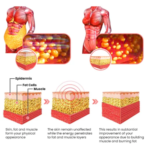 Oveallgo™ ULTRA Moovings Tummy Control Body Shaper Shorts - Image 10