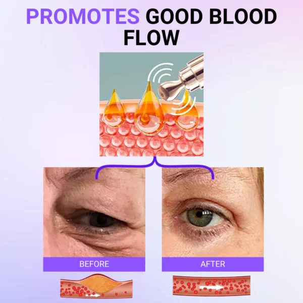 Milkease™ Milk Spots Therapy Electric Serum Pen - Image 3