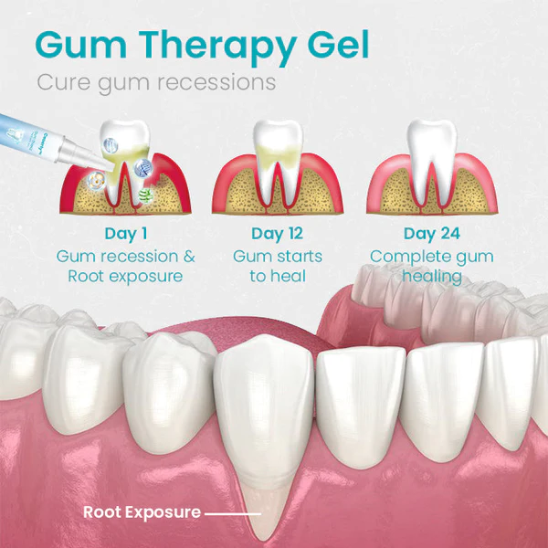 Ceoerty™ Gum Shield Therapy Gel - Image 7