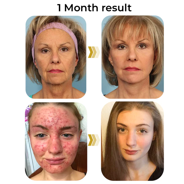 flysmus™ HERASKIN Australian Natural Pamper Cleansing Balm - Image 4