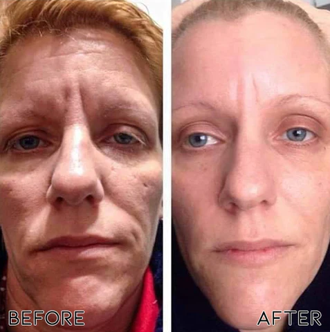 Oveallgo™ Rejuvenating Bioactive Collagen Nasal Inhaler - Image 3