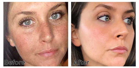 WE.Beauti™ Turmeric Natural Serum - Image 5