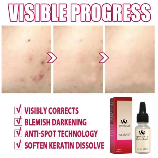 ORGANIC DARK SPOT SKIN SERUM - Image 5