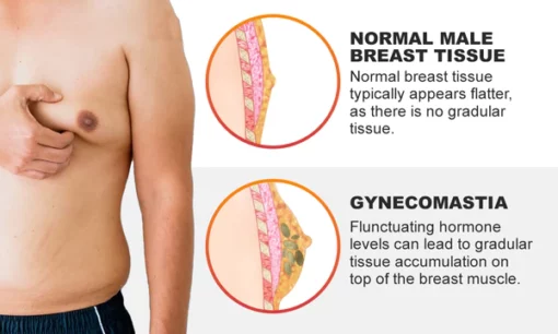 Luhaka™ Gynecomastia Cream – Chest Fat Burner - Image 3