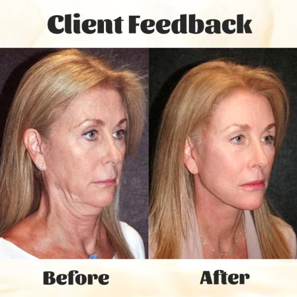 Ceoerty™ RevTime NMN Age-Defying Essence - Image 3