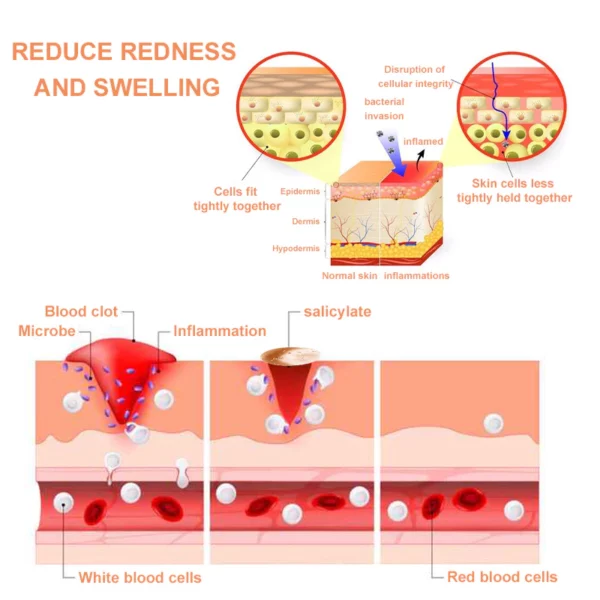 PUREVISAGE™ Salicylic Acid Pore Minimizing Essence - Image 3
