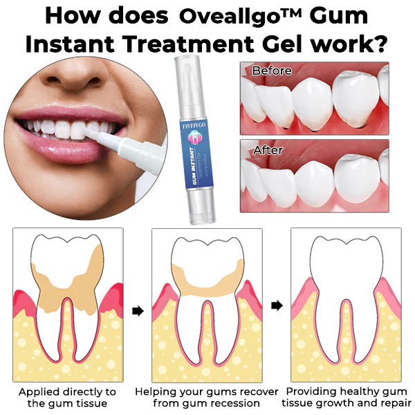 GFOUK™ Gum Instant Treatment Gel - Image 3